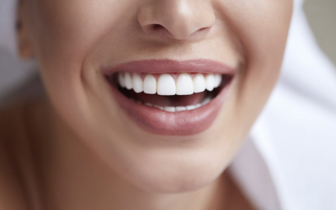 Estetica del sorriso