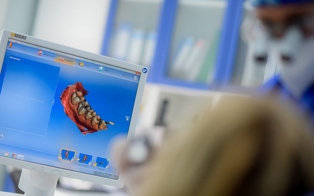 Impronta con telecamera digitale