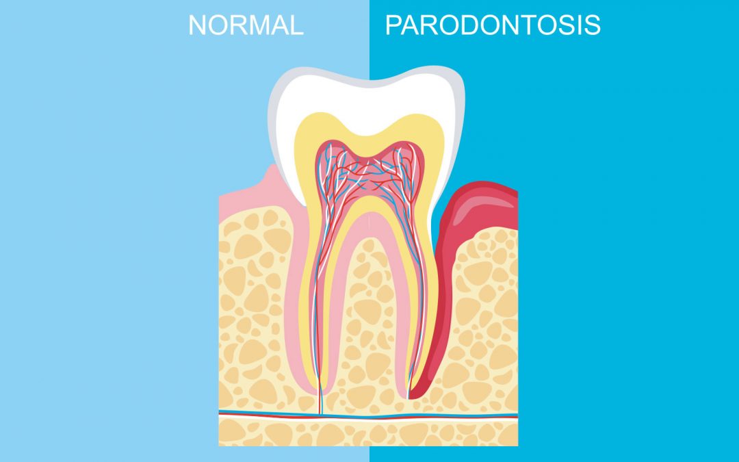 Parodontologia
